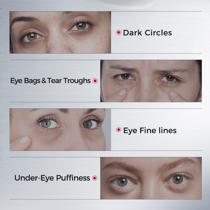 Eye Patches for Dark Circles – - Eye Pad Collagen recension och pris